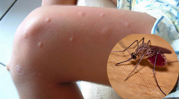 mosquitos_picadas