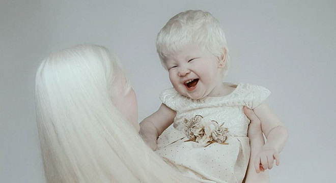 ensaio-deslumbrante-de-irmas-albinas-mostra-que-a-beleza-existe-nas-mais-diversas-formas2