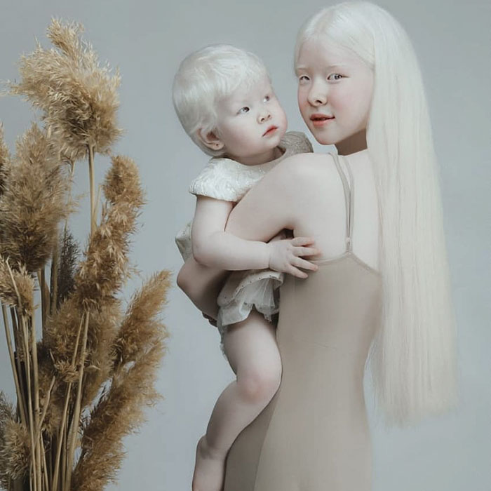 ensaio-deslumbrante-de-irmas-albinas-mostra-que-a-beleza-existe-nas-mais-diversas-formas3